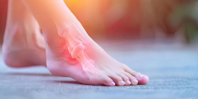 Close-up view of a woman's foot showing signs of plantar fasciitis pain. The image highlights the discomfort associated with foot pain, focusing on the heel area, a common symptom of plantar fasciitis. This concept is related to medical conditions and treatments for foot pain, emphasizing health and wellness.